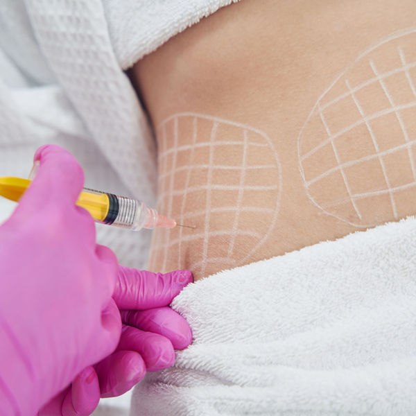 Fat dissolving injections at KH Aesthetics